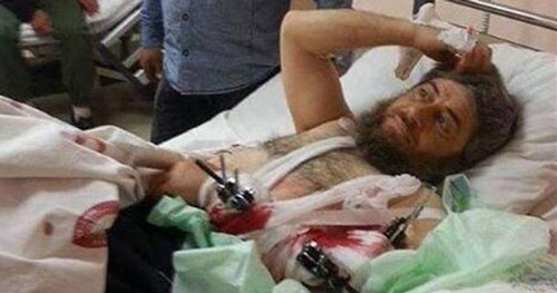 مسلم يعالج في المستشفى