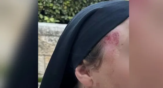 اعتداء على راهبة في القدس يثير غضبًا مسيحيًا ومطالبات بمحاسبة الجاني